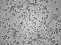 Распавшиеся на отдельные клетки споры Кордицепса офиоглоссовидного (Cordyceps ophioglossoides), х500; фото Андрея Смирнова