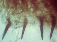 Щетинки в порах Феллинуса ржавого (Phellinus ferruginosus), x500; фото Андрея Смирнова