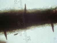 Щетинки на внутренней поверхности пор Феллинуса чёрноограниченного (Phellopilus nigrolimitatus), x400; фото Андрея Смирнова