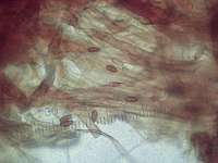 Гифы верхнего слоя шляпки и споры Феллинуса чёрноограниченного (Phellinus nigrolimitatus), x500; фото Андрея Смирнова