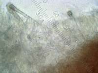 Стекхеринум Мурашкинского (Steccherinum murashkinskyi), инкрустированные цистиды, х400; фото Андрея Смирнова